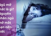 Ngủ mở mắt là gì? Nguyên nhân ngủ mở mắt bạn nên biết