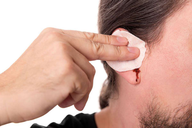 Hiện tượng nóng tai phải do tổn thương tai